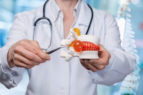 En diskusprolaps kan kræve kirurgi